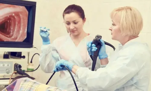 مين جربت منظار المعدة؟