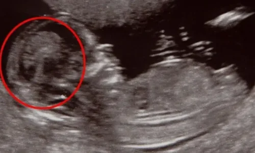 هل يخطئ السونار في البنت؟