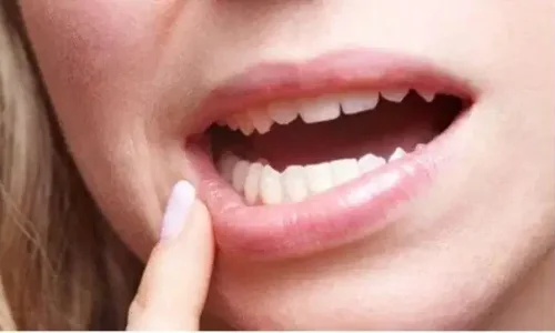 تفسير رؤية سقوط الأسنان في المنام للعزباء لابن سيرين