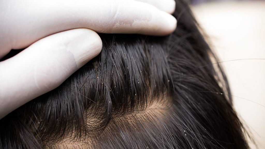 ما هو تفسير حلم الحشرات في الشعر لابن سيرين والنابلسي