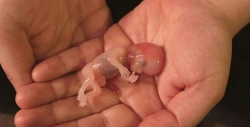 تعرف على تفسير الاجهاض في المنام لابن سيرين