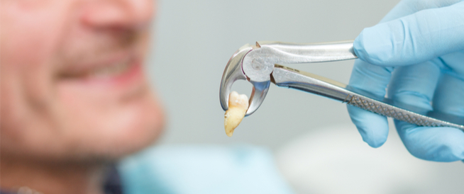 تفسير الحلم بخلع السن في المنام لابن سيرين