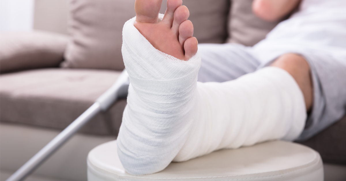 تفسير حلم كسر الرجل لابن سيرين